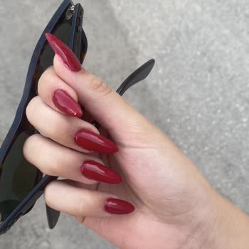 Hijyen Sorunu Ve Kalitesiz Hizmet