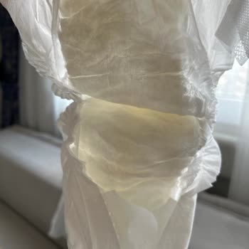 Bebek Bezlerinde Sızdırma Sorunu Ve Üretim Hatası