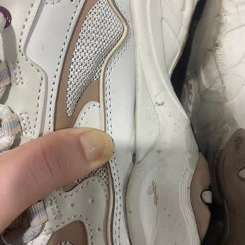 Skechers Ayakkabıda Kalite Sorunu Ve Müşteri Hizmetleri Hayal Kırıklığı