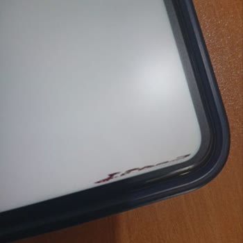 N11 Ölü Piksel Sorunu Ve Yetersiz Destek