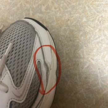 Skechers Ayakkabılarda 8 Ayda Dikiş Sökülmesi Ve Açılma Sorunu