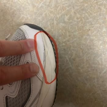 Skechers Ayakkabılarda 8 Ayda Dikiş Sökülmesi Ve Açılma Sorunu