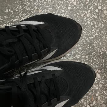 Hepsiburada'dan Aldığım Adidas Ayakkabı Yırtıldı Ve Destek Alamadım!