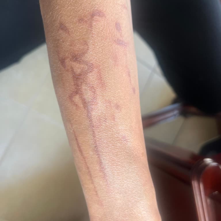 Kübra Öztürk Beauty Lounge Vıp Etlik Şubesinin Sorumsuzluğu!