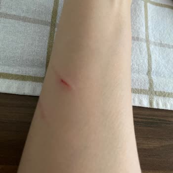 Sessiz Çalışması Beklenen Ürün Gürültülü Çıktı