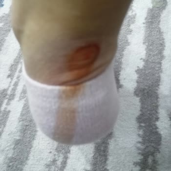 Trendyol'dan Gelen Sahte Ayakkabı Sorunu