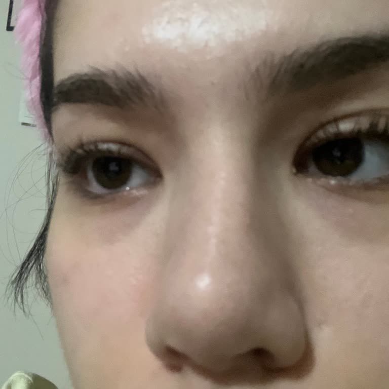 Estethica verlangt Geld für die Korrektur ihres eigenen Fehlers