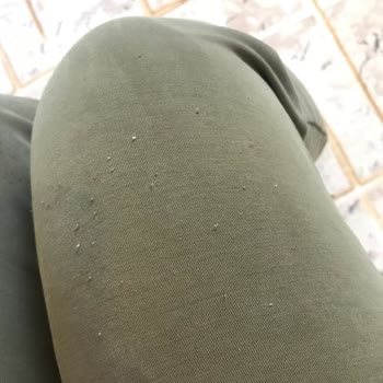 Slazenger Eşofman Altında Büyük Hayal Kırıklığı