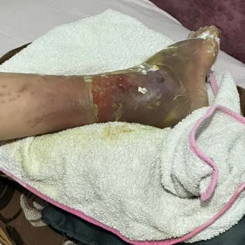 Yanlış Tedavi Mağduriyeti: Hayati Risk Taşıyan Hatalar