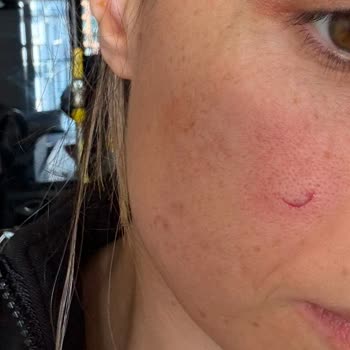 Madame Coco Patlayan Tencere Şoku!