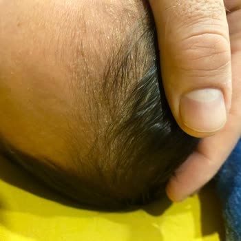 Mustela Şampuan Konak Sorununu Çözmüyor