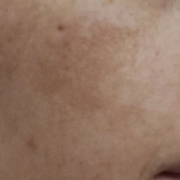 Esse Life Yozgat Yanıltıcı Cilt Bakımı Deneyimi