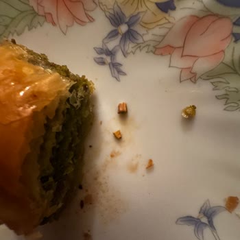 Baklavada Dişe Zarar Veren Yabancı Madde Şoku