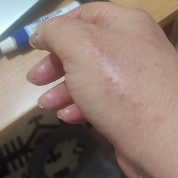 Cillit Bang Ürünü Ellerimi Tehlikeye Attı!