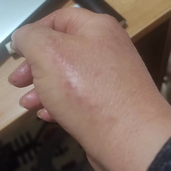 Cillit Bang Ürünü Ellerimi Tehlikeye Attı!