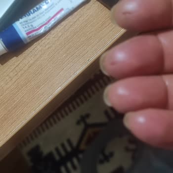 Cillit Bang Ürünü Ellerimi Tehlikeye Attı!