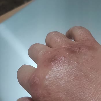 Cillit Bang Ürünü Ellerimi Tehlikeye Attı!