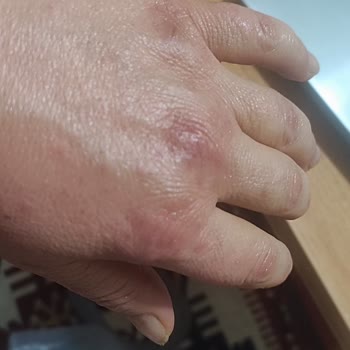 Cillit Bang Ürünü Ellerimi Tehlikeye Attı!