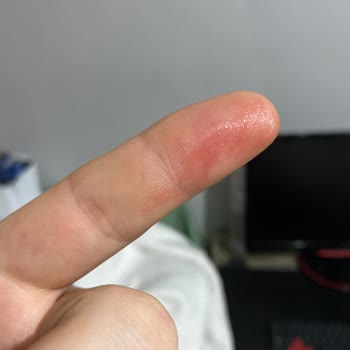 Aldığım Parfüm Kıyafetlerimde Leke Bıraktı