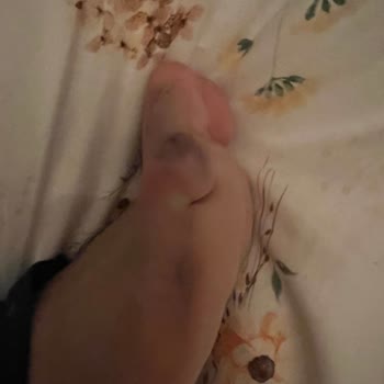 Ayakkabının Sağlık Sorunlarına Yol Açması