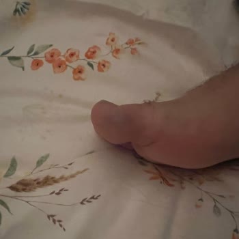 Ayakkabının Sağlık Sorunlarına Yol Açması