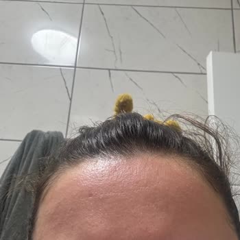 Rossmann Alterra C Vitamini Serum Mağduriyeti