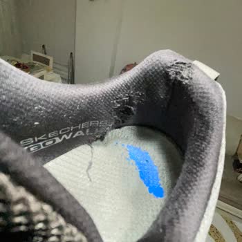 Garanti Kapsamında Mağduriyet: Skece Ayakkabı Sorunu