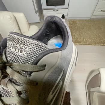 Garanti Kapsamında Mağduriyet: Skece Ayakkabı Sorunu