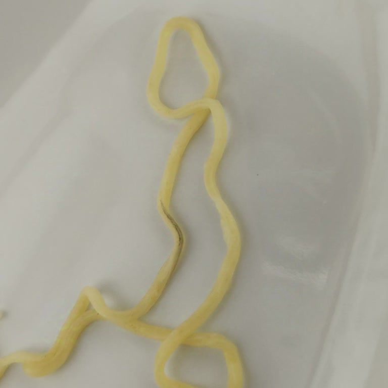 Noodle Paketinde İstenmeyen Sürpriz