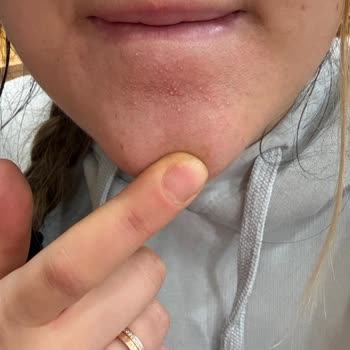 Cilt Bakım Ürünleri Hayal Kırıklığı Yarattı