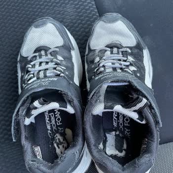 Skechers Ayakkabılarında Taban Çökmesi Ve Yetersiz Müşteri Hizmeti