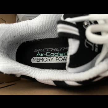 Skechers Ayakkabıda Tiftiklenme Sorunu Ve Yetersiz Destek