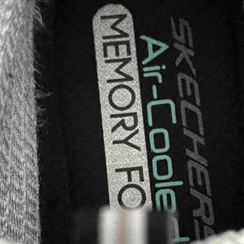 Skechers Ayakkabıda Tiftiklenme Sorunu Ve Yetersiz Destek