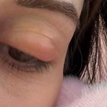 Emsal Doğan Güzellik Merkezi İpek Kirpik Uygulamasında Yaşanan Sorunlar Ve İlgisizlik