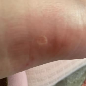 Ayakkabı İade Sürecinde Müşteri Mağduriyeti