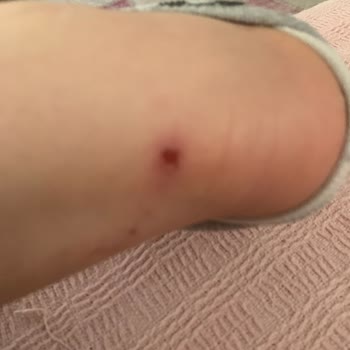 Ayakkabı İade Sürecinde Müşteri Mağduriyeti