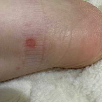 Ayakkabı İade Sürecinde Müşteri Mağduriyeti