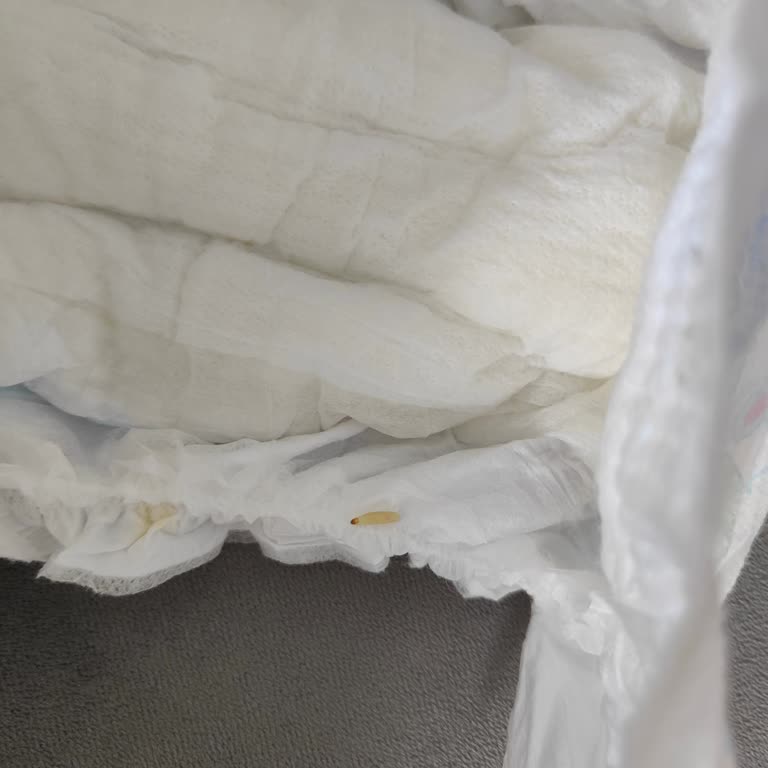 Molfix Bebek Bezinde Kurt Şoku