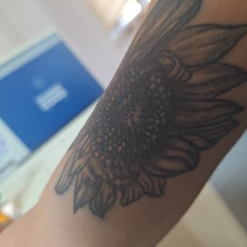 Batman Tattoo Dövme Salonu Kalitesiz Yapılan Dövme İşlemi