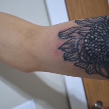 Batman Tattoo Dövme Salonu Kalitesiz Yapılan Dövme İşlemi