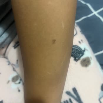 Mina Güzellik'te Tekrar Yanık Sorunu Ve İlgisizlik