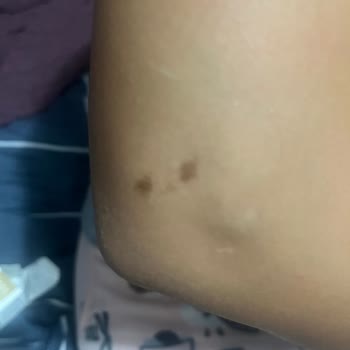 Mina Güzellik'te Tekrar Yanık Sorunu Ve İlgisizlik