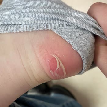 Tommy Hilfiger Botlarıyla Yaşanan Ayak Sıkıntısı