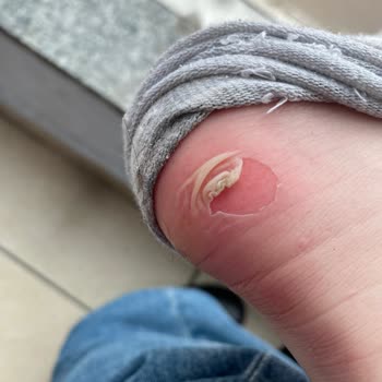 Tommy Hilfiger Botlarıyla Yaşanan Ayak Sıkıntısı