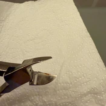 Paslanan Çelik Ürün Ve Watsons'ın İlgisizliği