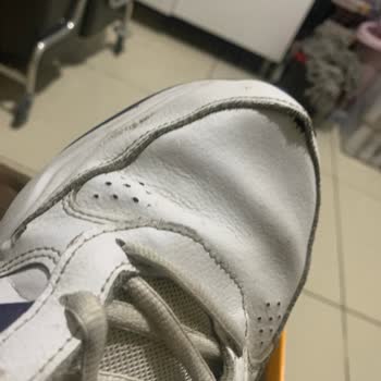 Adidas Ayakkabıda Dikiş Problemi Ve Yetersiz Müşteri Hizmeti