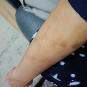 Lavinya Golden Güzellik Merkezi'nde Hayal Kırıklığı Ve Yanıltıcı Hizmet