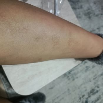 Lavinya Golden Güzellik Merkezi'nde Hayal Kırıklığı Ve Yanıltıcı Hizmet