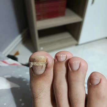 Tedavi Süreci Sonunda Artan Sorunlar Ve Yetersiz İletişim