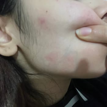 Yves Rocher Ürünleri Cildimi Mahvetti